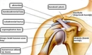 Sol Omuz ve Kol Ağrısı Belirtileri ve Tedavisi